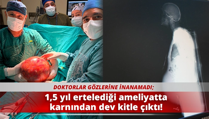 1,5 yıl ertelediği ameliyatta karnından dev kitle &ccedil;ıktı!