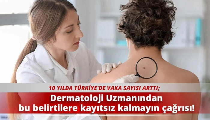 Dermatoloji Uzmanından bu belirtilere kayıtsız kalmayın çağrısı!